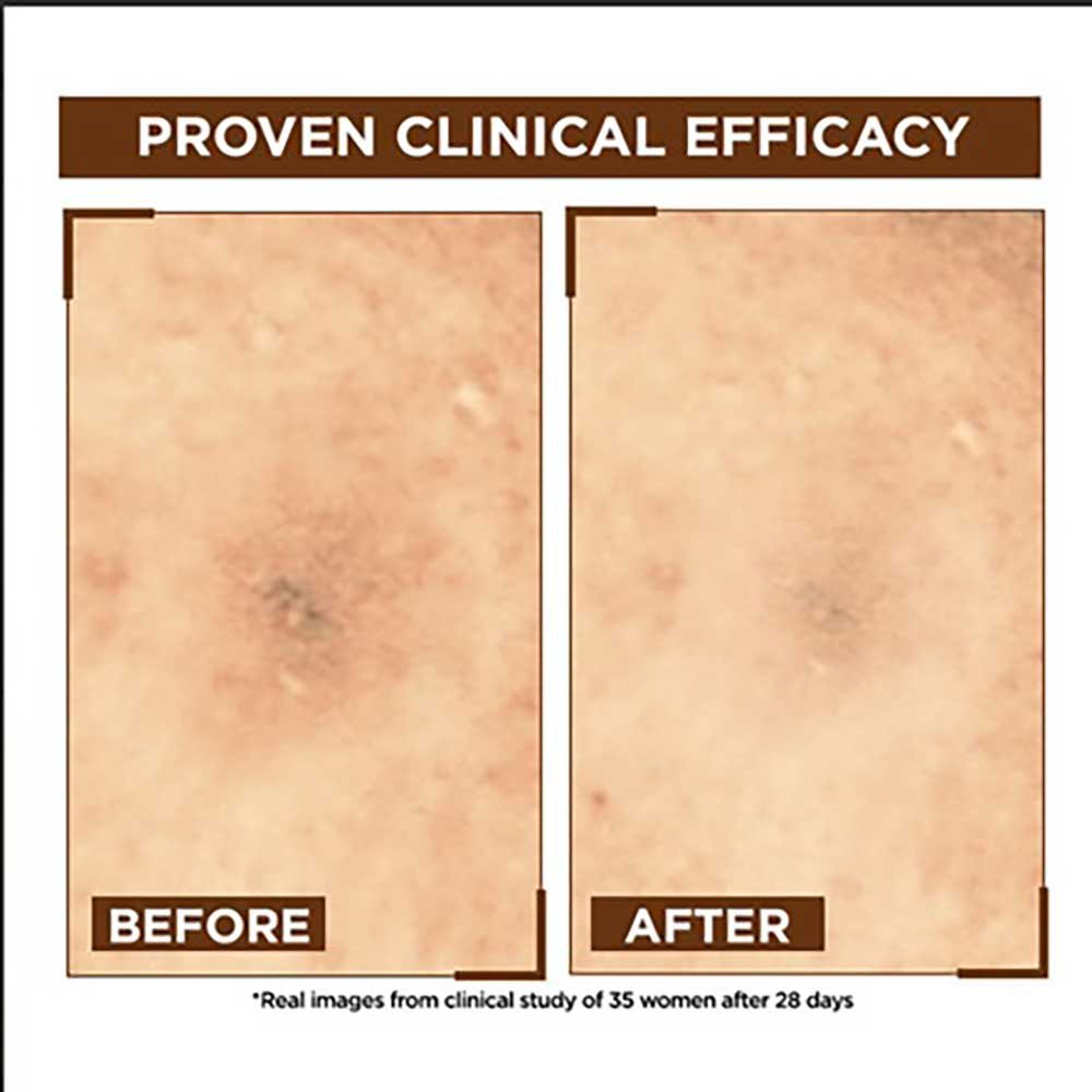 Night Vitamin C Serum Before After